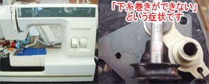 ジャノメミシン修理　3101