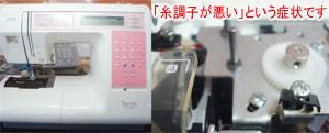 ブラザーミシン修理　Ｂ893テンディー7000